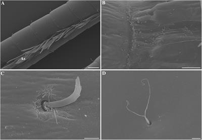 Blow Your Nose, Shrimp! Unexpectedly Dense Bacterial Communities Occur on the Antennae and Antennules of Hydrothermal Vent Shrimp